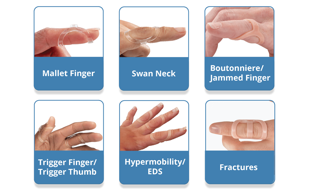 The Original Oval8 Finger Splints 3Point Products